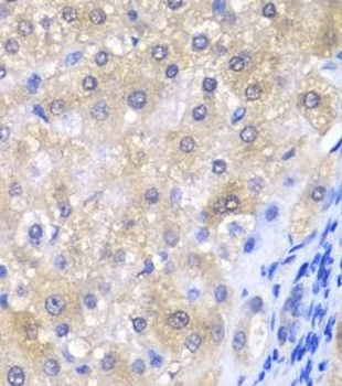 GPX4 Rabbit Polyclonal Antibody