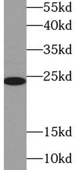 GPX8 Rabbit Polyclonal Antibody