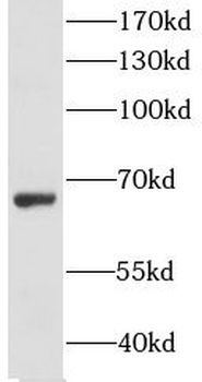 GRB7 Rabbit Polyclonal Antibody