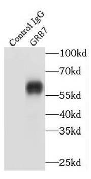GRB7 Rabbit Polyclonal Antibody