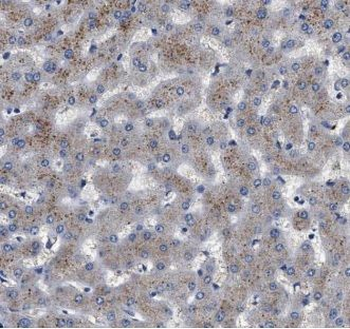 GRHPR Rabbit Polyclonal Antibody