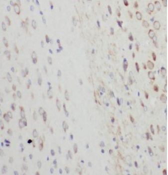 GRIPAP1 Rabbit Polyclonal Antibody