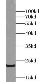 GH1 Rabbit Polyclonal Antibody