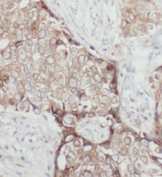 HSP90B1 Antibody
