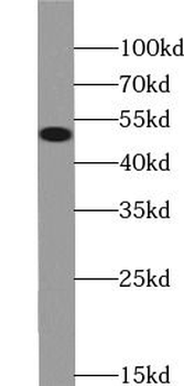 GSDMD Rabbit Polyclonal Antibody