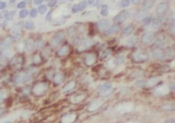 GSDMD Rabbit Polyclonal Antibody