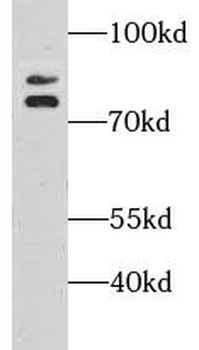 GSPT1 Rabbit Polyclonal Antibody