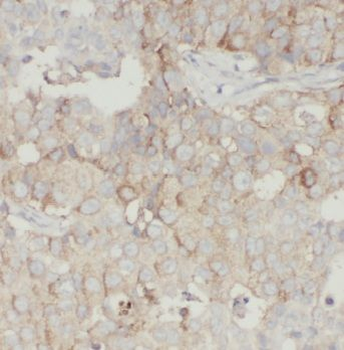 GSPT1 Rabbit Polyclonal Antibody