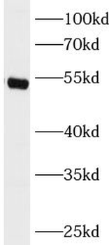 GSR Rabbit Polyclonal Antibody