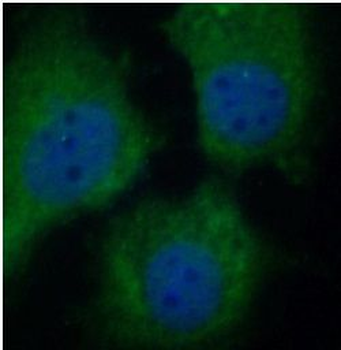GSR Rabbit Polyclonal Antibody