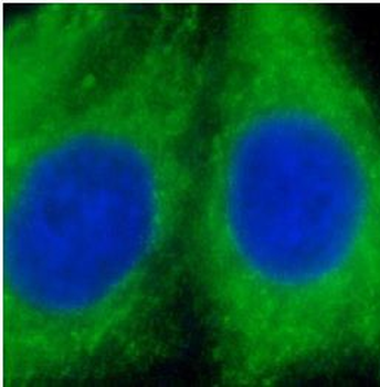 GSTA1 Rabbit Polyclonal Antibody