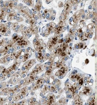 GSTA1 Rabbit Polyclonal Antibody