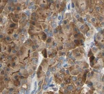 GSTA2 Rabbit Polyclonal Antibody