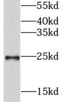 GSTA3 Rabbit Polyclonal Antibody