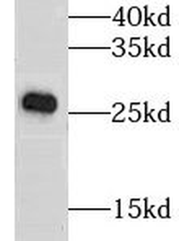 GSTK1 Rabbit Polyclonal Antibody