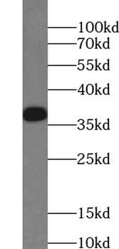 GSTO1 Rabbit Polyclonal Antibody
