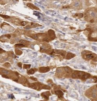 GSTO1 Rabbit Polyclonal Antibody