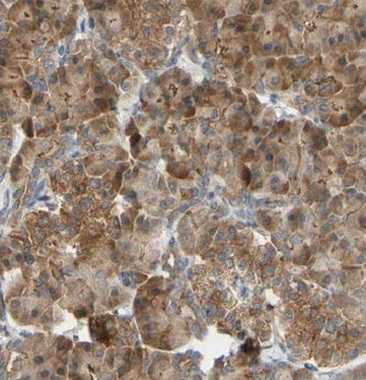 GSTO1 Mouse Monoclonal Antibody