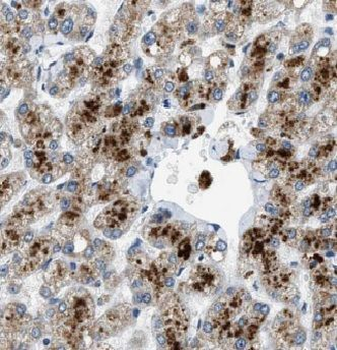 GSTT1 Rabbit Polyclonal Antibody