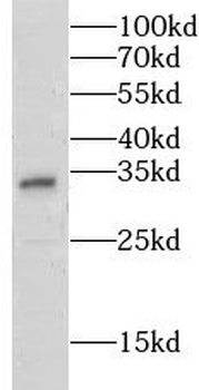 GSTZ1 Rabbit Polyclonal Antibody