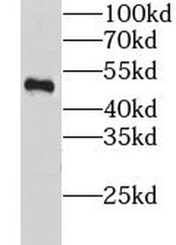 GTF2A1 Rabbit Polyclonal Antibody