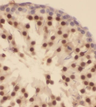 GTF2A1 Rabbit Polyclonal Antibody