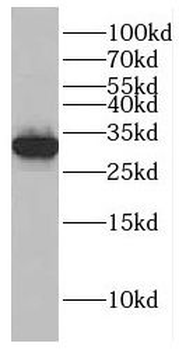 GTF2H3 Rabbit Polyclonal Antibody