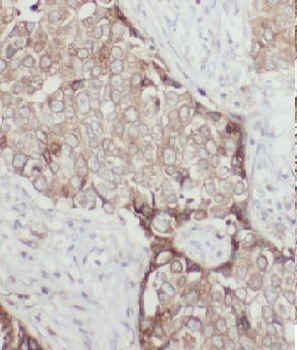 GTPBP3 Rabbit Polyclonal Antibody