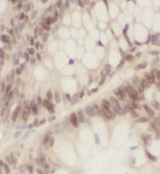 OLA1 Rabbit Polyclonal Antibody