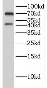 GYG2 Rabbit Polyclonal Antibody