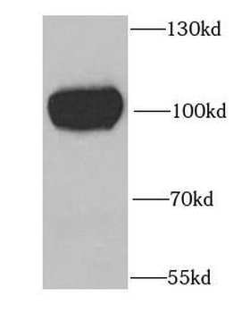 GYS1 Rabbit Polyclonal Antibody