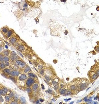 GYS1 Rabbit Polyclonal Antibody