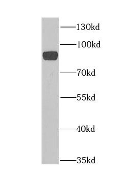 H6PD Rabbit Polyclonal Antibody
