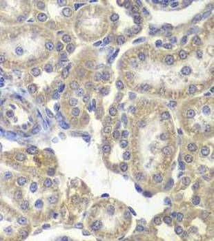 H6PD Rabbit Polyclonal Antibody