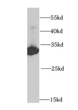 HADH Rabbit Polyclonal Antibody