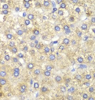 HADH Rabbit Polyclonal Antibody