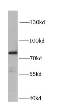 HADHA Rabbit Polyclonal Antibody