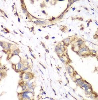 HADHA Rabbit Polyclonal Antibody