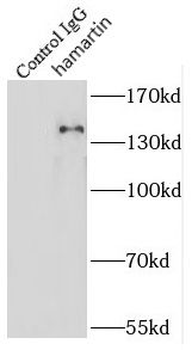 TSC1 Rabbit Polyclonal Antibody