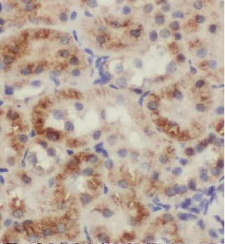 TSC1 Rabbit Polyclonal Antibody