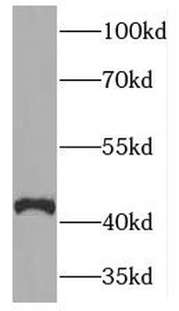 HAPLN4 Rabbit Polyclonal Antibody