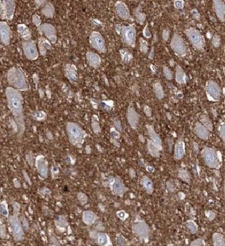 HAPLN4 Rabbit Polyclonal Antibody