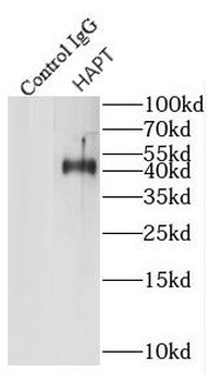HP Rabbit Polyclonal Antibody