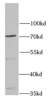 HAS3 Rabbit Polyclonal Antibody