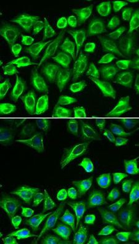 HAS3 Rabbit Polyclonal Antibody