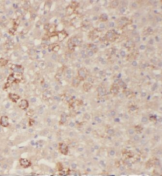 HAS3 Rabbit Polyclonal Antibody