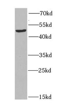 HAT1 Rabbit Polyclonal Antibody
