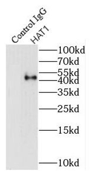 HAT1 Rabbit Polyclonal Antibody