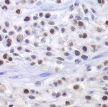 HAT1 Rabbit Polyclonal Antibody