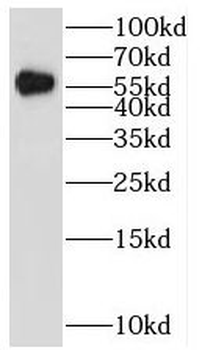 HBP1 Rabbit Polyclonal Antibody
